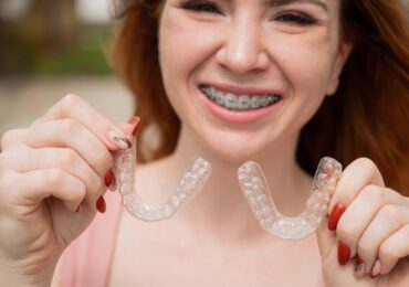 antalya retainer pekiştirme tedavisi