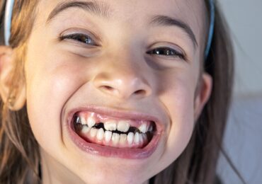 antalya gelişimsel iskeletsel tedaviler