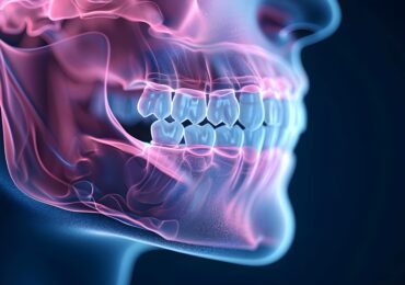 antalya ortognatif cerrahi tedaviler