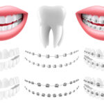 ortodontik tedavi fiyatları