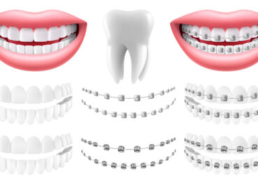 ortodontik tedavi fiyatları