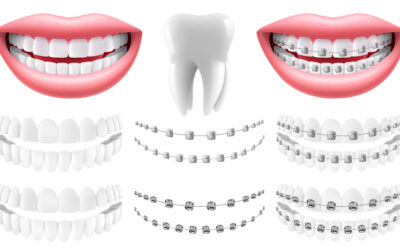 ortodontik tedavi fiyatları