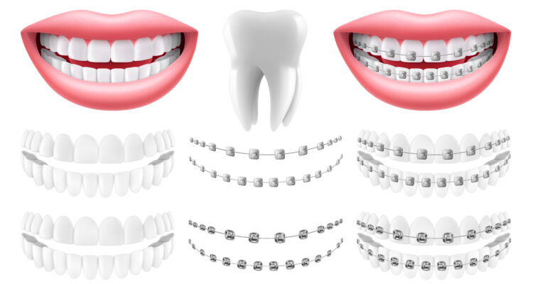 ortodontik tedavi fiyatları