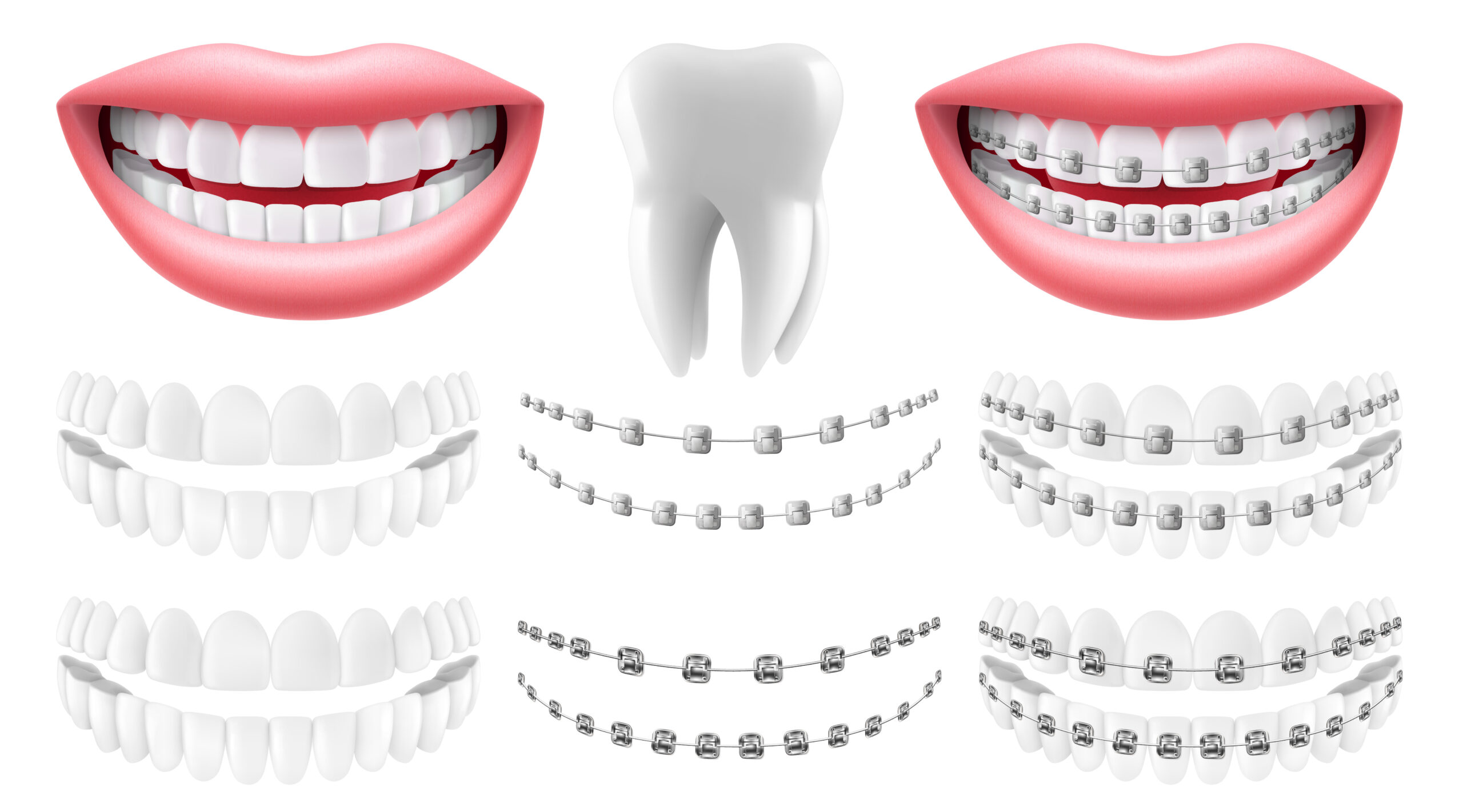ortodontik tedavi fiyatları